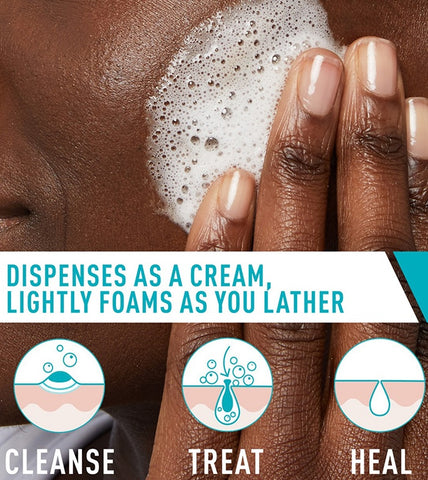 Acne Foaming Cream Cleanser