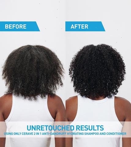 2-in-1 Anti-Dandruff Hydrating Shampoo and Conditioner