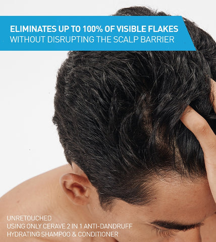 2-in-1 Anti-Dandruff Hydrating Shampoo and Conditioner