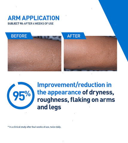 Intensive Moisturizing Lotion